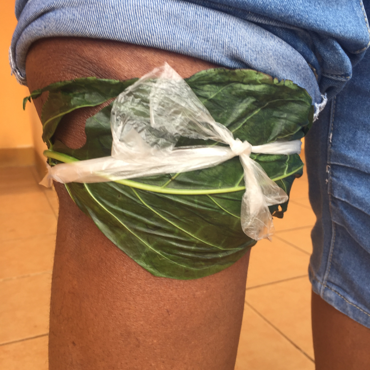 Indian mulberry leaf and coconut oil compress